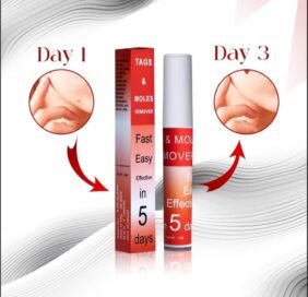 Tags & Moles Remover (Pack of 2) - Image 7