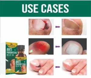 Anti Paronychia Relief Oil 20 ml Pack of 2 - Image 4