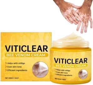 Bee venom cream for joint pain relief 30gm herbal anti inflammatory cream