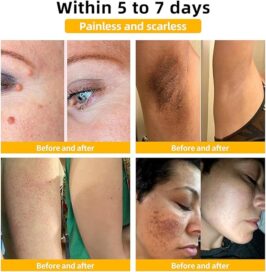 Bee Venom Skin Treatment Cream,Repair Maximum Strength for All Skin Types (2PCS) - Image 4