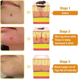 Bee Venom Skin Treatment Cream,Repair Maximum Strength for All Skin Types (2PCS) - Image 2